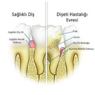 dentmega-tedavi